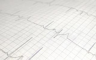 Cardiogram chart with medical table closeup, for Surgeon heart record, selective focus photo