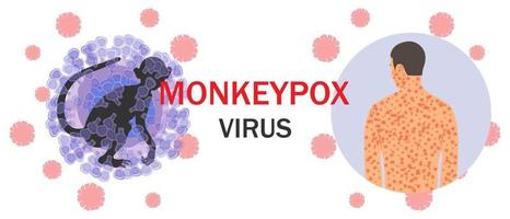 Banner with monkeypox virus cells, monkey silhouette, text and human body with rash on microbiology background. The concept of a viral disease and its symptoms. Vector illustration.