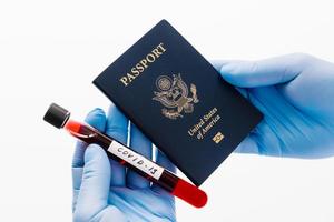 Hands in medical gloves hold blood sample for coronavirus and passport. Border control and quarantine for tourists. Postponed flight because of virus outbreak photo