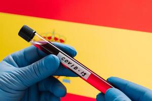 Infected blood sample in tube against Spain flag background. Coronavirus outbreak in Europe. Virus testing concept. Medical research, diagnosis photo