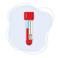 tubo de ensayo con sangre para la determinación del virus de la viruela del mono. vector