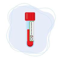 Test tube with blood for the determination of the monkeypox virus. vector