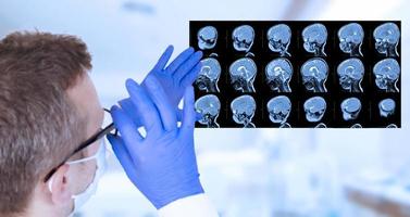 Doctor in glasses and medical gloves examines an MRI scan of the child's brain in the laboratory. photo