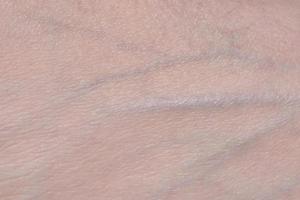 veins on the skin photo