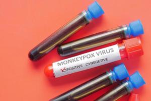 monkeypox text on blood text tube on red background photo