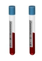 tubos de ensayo realistas con muestras de sangre para análisis de coronavirus. resultado positivo y negativo. vector aislado sobre fondo blanco