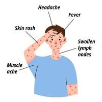 Monkeypox virus symptom infographic on patient with fever, headache, swollen lymph node, rashes on face, body and back, muscle aches. Vector flat isolated illustration for print.