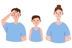 Set monkeypox virus symptom on patient with fever, headache, swollen lymph node, rashes on face, body and back, muscle aches. Vector flat isolated illustration for print.