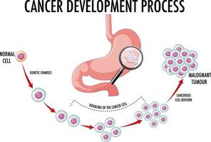 diagrama que muestra el proceso de desarrollo del cáncer vector