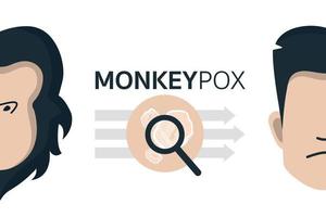 Monkeypox virus outbreak spreading concept. Infected people from monkey. Monkeypox on human skin closeup. Flat design. New cases of Monkeypox virus in Europe and USA vector