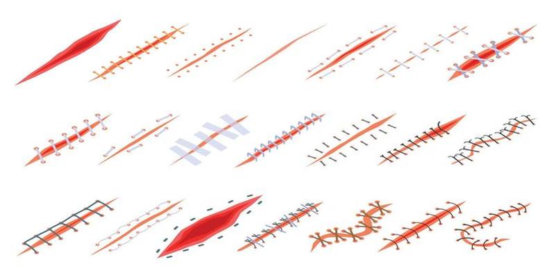 Suture icons set, isometric style
