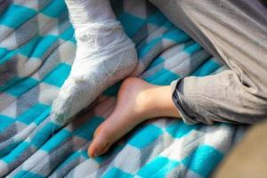 niño con vendaje en la fractura del talón de la pierna. pie derecho roto, férula de niño pequeño. niño durmiendo en una manta azul. foto