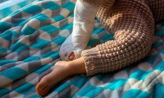 Child with bandage on leg heel fracture. Broken right foot, splint of toddler. Little boy sleeping on a blue blanket. photo