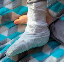 Child with bandage on leg heel fracture. Broken right foot, splint of toddler. Little boi sleeping on a blue blanket. photo