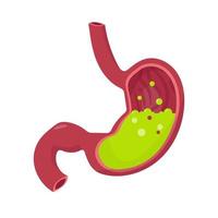 Human stomach anatomy. Green liquid inside stomach. Nausea. Diseases of the stomach. Vomiting. Medical vector illustration isolated on white background.