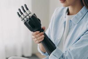 Handicapped young woman is disassembling cyber sensor hand. Electronic artificial arm. photo