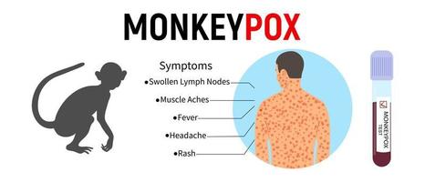 Banner with a silhouette of a monkey, a test tube for blood, with a text of the symptoms of monkeypox and a human body with a rash. Concept of a viral disease and its symptoms. Vector illustration.