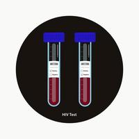 HIV blood testing in tubes with positive an negative labels  vector illustration