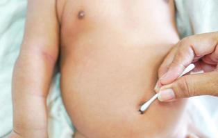 Mother use a cotton swab to clean the navel of newborn baby. Cleanliness, hygiene, empathy.