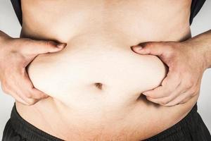 Overweight man body with hands touching belly fat