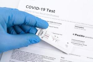 resultado positivo de la prueba mediante el uso de un dispositivo de prueba rápida para covid-19. foto