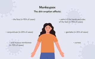 Information poster symptom of monkeypox vector