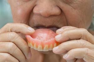 Asian senior or elderly old woman patient holding to use denture in nursing hospital ward, healthy strong medical concept photo