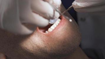 revisión dental del dentista. el dentista comprueba la solidez de los dientes del paciente. video