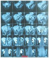 Abdomen MRI scan photo