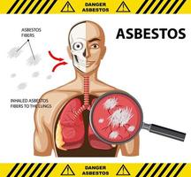 Diagram showing asbestosis in lungs vector