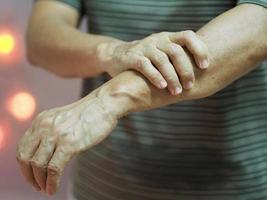 woman holding hands rare disorder body immune system attacks nerves, Guillan Barre Syndrome, Vaccine covid-19 coronavirus Treatment photo