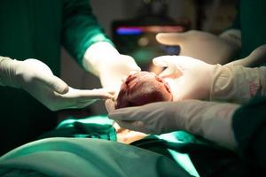 Professor of medicine in cardiology and a team of doctors in the operating room undergoing heart transplant surgery photo