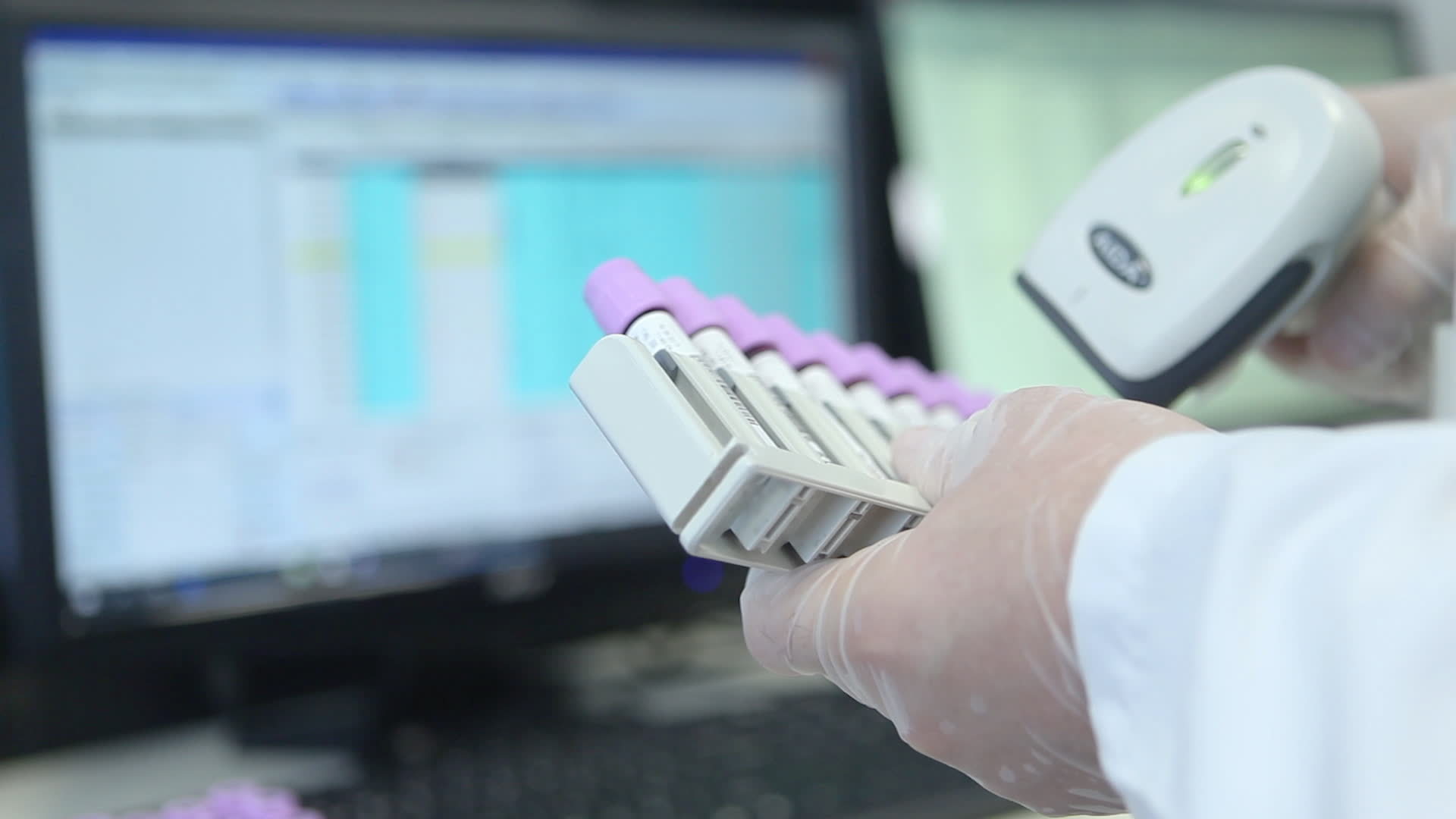 laboratory blood tube. Reading QR codes in the laboratory. blood tube ...