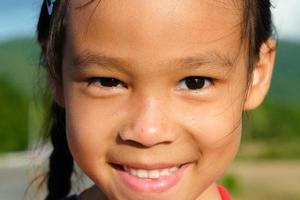 Healthy smiling face of a cute little girl with a sunburn on her face. Happy little Asian girl child showing front teeth with big smile and laughing. Beauty and health of the skin. photo