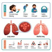 infografía pulmonar, estilo de dibujos animados vector