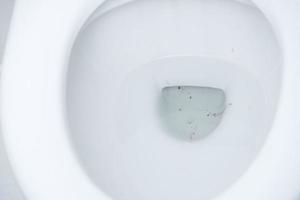 Black stain in the toilet bowl. photo