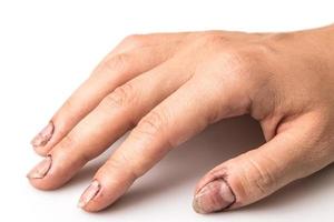 manos femeninas con uñas sucias foto