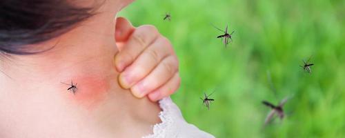 cute asian baby girl has rash and allergy on neck skin from mosquito bite and sucking blood while playing outdoor photo