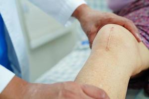 médico revisando a una anciana asiática con cirugía de reemplazo de rodilla con cicatriz en el hospital. foto