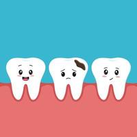 Vector illustration of healthy character teeth with smiles and a sad tooth with decay and a hole in the gums. Children's dentistry concept.