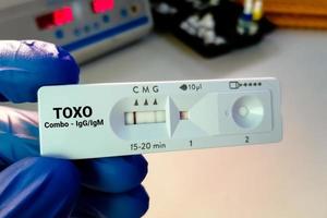 Rapid test cassette for Toxoplasma Antibody test. toxoplasma gondii photo