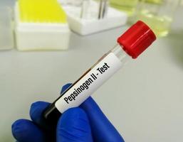 Scientist hold blood sample for Pepsinogen or PG II test, diagnosis for early detection of gastric cancer photo