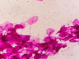 Gram staining, also known as Gram's method, is a method of differentiating bacterial species into two large groups called Gram positive and Gram negative. photo