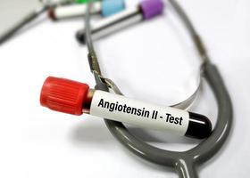 Blood sample for Angiotensin II test. photo