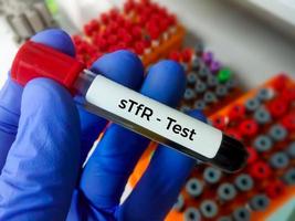 Soluble transferrin receptor or sTfR test. this test help to detect and evaluate iron deficiency and aid in the diagnosis of iron deficiency anemia. photo