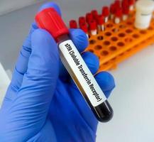 Soluble transferrin receptor or sTfR test. this test help to detect and evaluate iron deficiency and aid in the diagnosis of iron deficiency anemia. photo