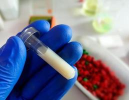 Medical scientist hold Lipemic blood sample in laboratory, high Triglyceride contain serum sample photo