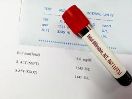 Blood sample for ALT, AST and Total Bilirubin test with abnormal report. LFTs or Liver Function Tests. photo