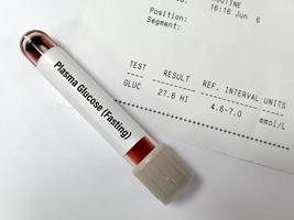 Sample tube of Plasma glucose Fasting test with abnormal report called hyperglycemia. photo