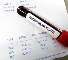 Blood sample isolated for Liver function test or LFTs including ALT, AST and Total bilirubin with abnormal patient report. photo